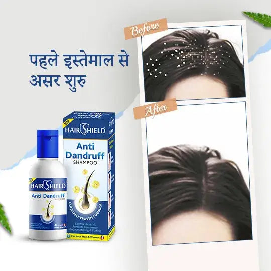 Hairshield Anti Dandruff Shampoo Travel Pack | Prevents Dandruff, Hair Fall & Flaky Scalp | Suitable for All Hair Types Men & Women | Trusted Brand for Smooth Hair | Pack of 3x30ml