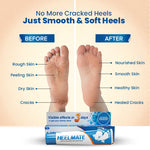 Load image into Gallery viewer, Heelmate Daily Foot Care Combo | Cracked Heel Repair Cream Pack of 1 with Ankle Length Socks (Pink) | Deep Moisture &amp; Soothing Care for Dry Heels | Feather-Touch Socks Included
